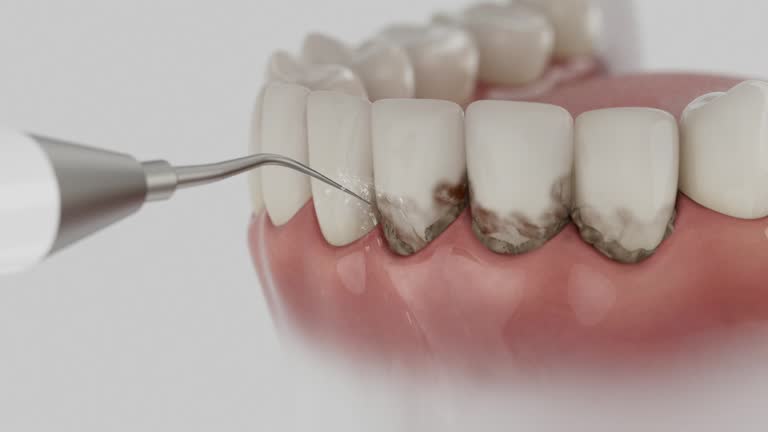 Trusted Root Canal Treatment service in Lexington, NC - Dentist Open Now